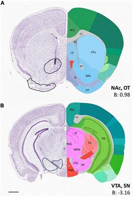 Gestational VPA exposure reduces the density of juxtapositions between TH+ axons and calretinin or calbindin expressing cells in the ventrobasal forebrain of neonatal mice